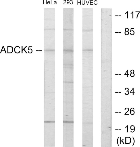 Antibodie to-ADCK5 