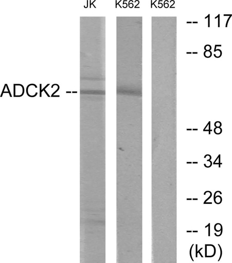 Antibodie to-ADCK2 