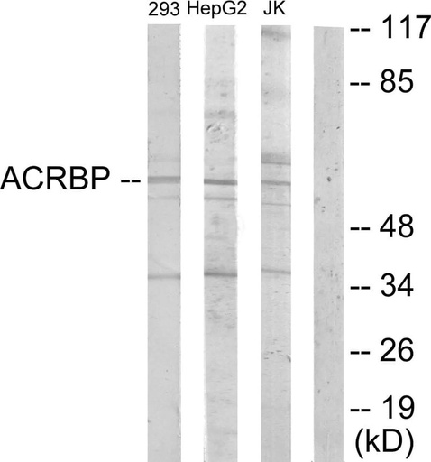 Antibodie to-ACRBP 