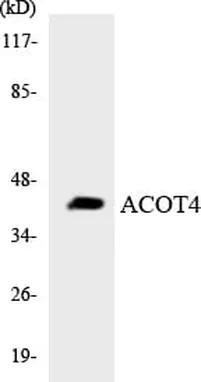 Antibodie to-ACOT4 