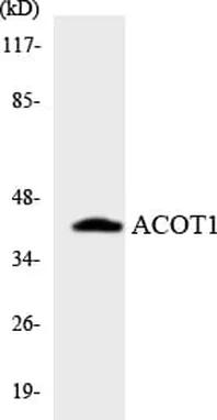 Antibodie to-ACOT1 