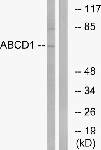 Antibodie to-ABCD1 