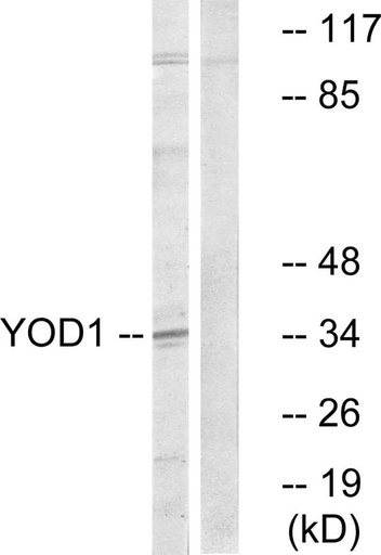 Antibodie to-YOD1 