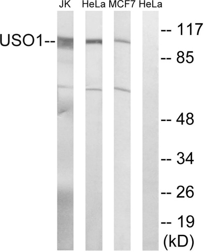 Antibodie to-USO1 