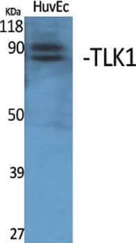 Antibodie to-TLK1 