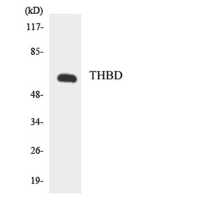 Antibodie to-THBD 