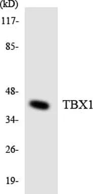 Antibodie to-TBX1 