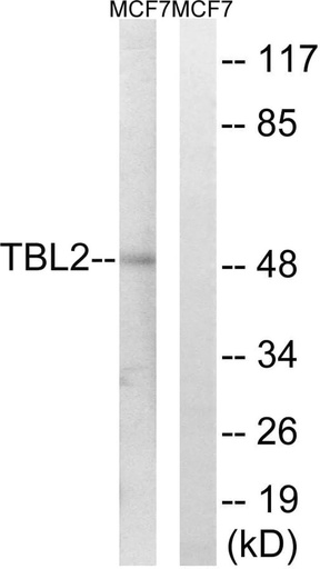 Antibodie to-TBL2 