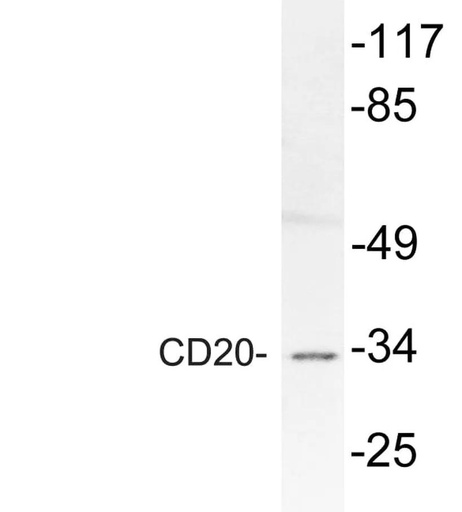 Antibodie to-CD20 