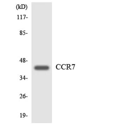 Antibodie to-CCR7 