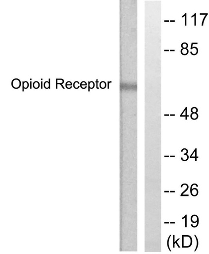 Antibodie to-CCR5 