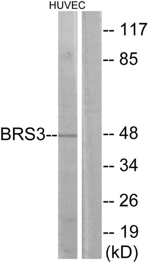 Antibodie to-BRS3 