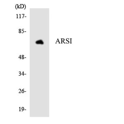 Antibodie to-ARSI 