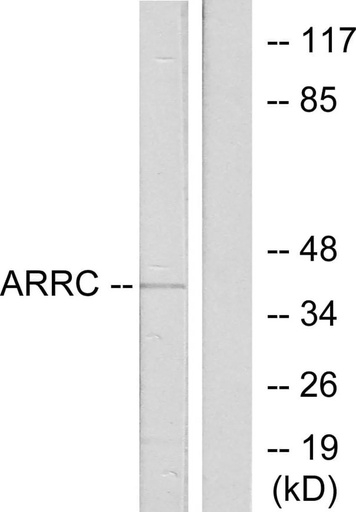 Antibodie to-ARRC 