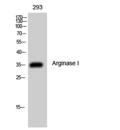Antibodie to-ARG1 