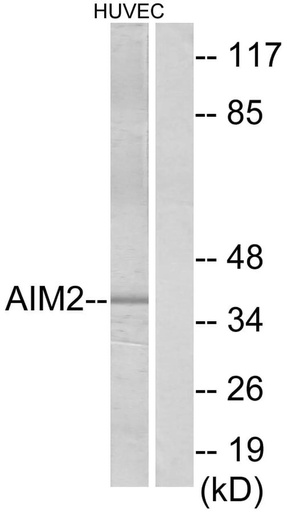 Antibodie to-AIM2 