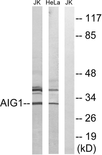 Antibodie to-AIG1 