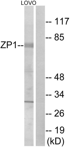 Antibodie to-ZP1 