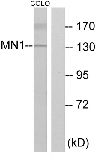 Antibodie to-MN1 