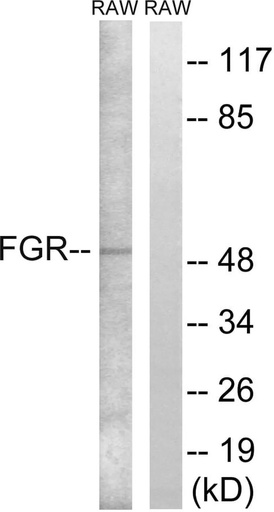 Antibodie to-FGR 
