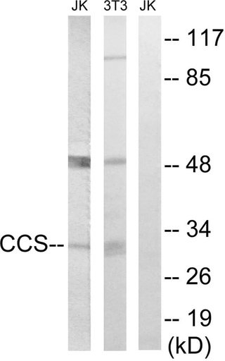 Antibodie to-CCS 
