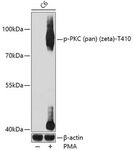 Antibodie to-PKC zeta (pan) (phospho T410) 