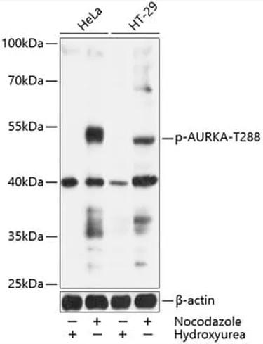 Antibodie to-AURKA (phospho T288) 