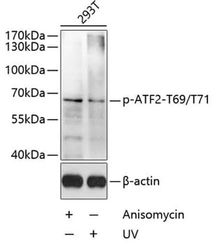 Antibodie to-ATF2 (phospho T69 + T71) 