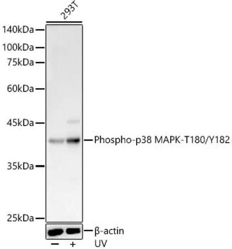 Antibodie to-MAPK14 (phospho T180 + Y182) 