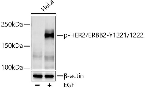 Antibodie to-ERBB2 (phospho Y1221 + Y1222) 