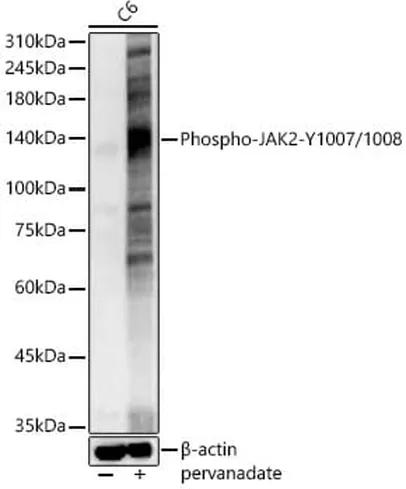 Antibodie to-Jak2 (phospho Y1007 + Y1008) 