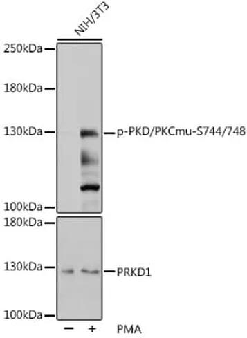 Antibodie to-PKD (phospho S744 + S748) 