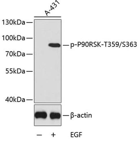 Antibodie to-P90RSK (phospho T359 + S363) 