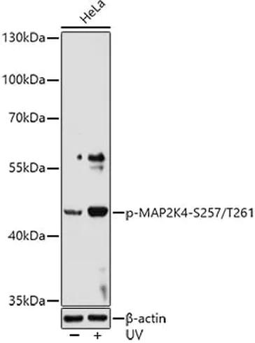 Antibodie to-MAP2K4 (phospho S257 + T261) 