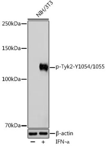 Antibodie to-Tyk2 (phospho Y1054 + Y1055) 