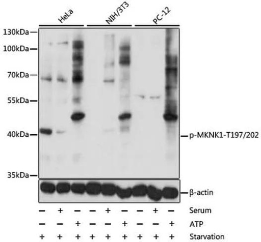 Antibodie to-MKNK1 (phospho T197 + T202) 
