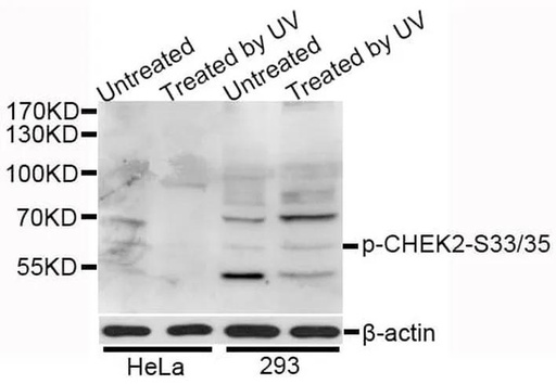 Antibodie to-CHEK2 (phospho S33 + S35) 