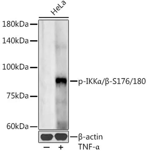 Antibodie to-IKK alpha + beta (phospho S176 + S180) 