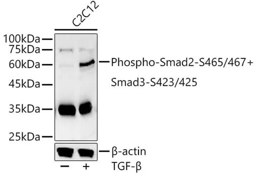 Antibodie to-SMAD2 (phospho S465 + S467) + SMAD3 (phospho S423 + S425) 