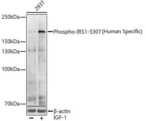 Antibodie to-IRS1 (phospho S307) 