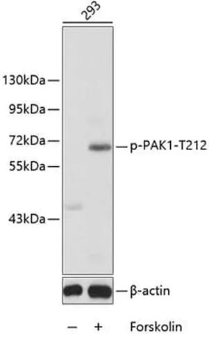 Antibodie to-PAK1 (phospho T212) 