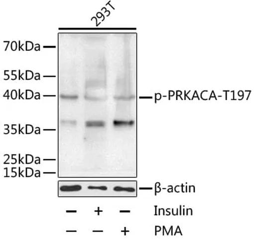 Antibodie to-PRKACA (phospho T197) 