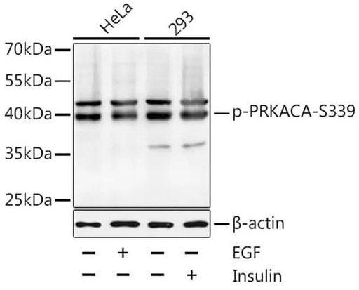 Antibodie to-PRKACA (phospho S339) 