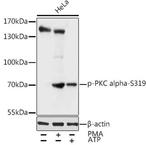 Antibodie to-PKC alpha (phospho S319) 
