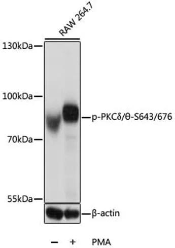 Antibodie to-PKC delta (phospho S643) + PKC thetha (phospho 676) 