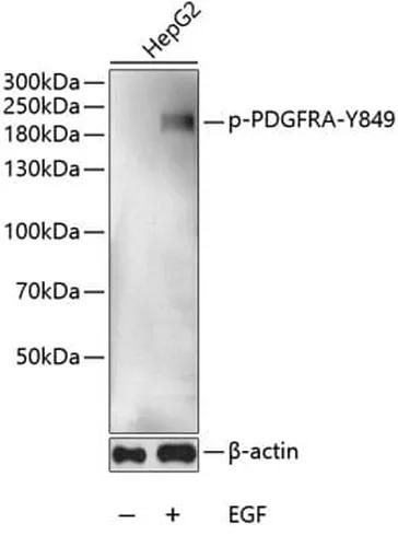 Antibodie to-PDGFRA (phospho Y849) 