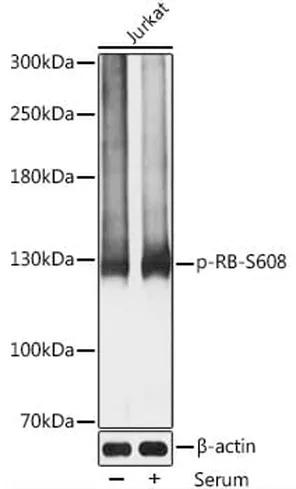 Antibodie to-RB1 (phospho S608) 