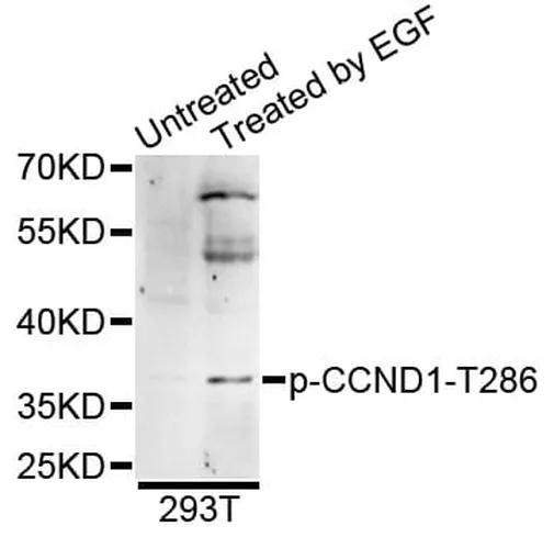 Antibodie to-CCND1 (phospho T286) 