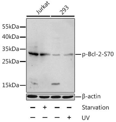 Antibodie to-BCL2 (phospho S70) 