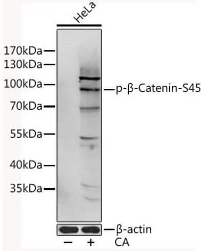 Antibodie to-CTNNB1 (phospho S45) 